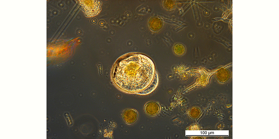 Phytoplankton mit Veligerlarve